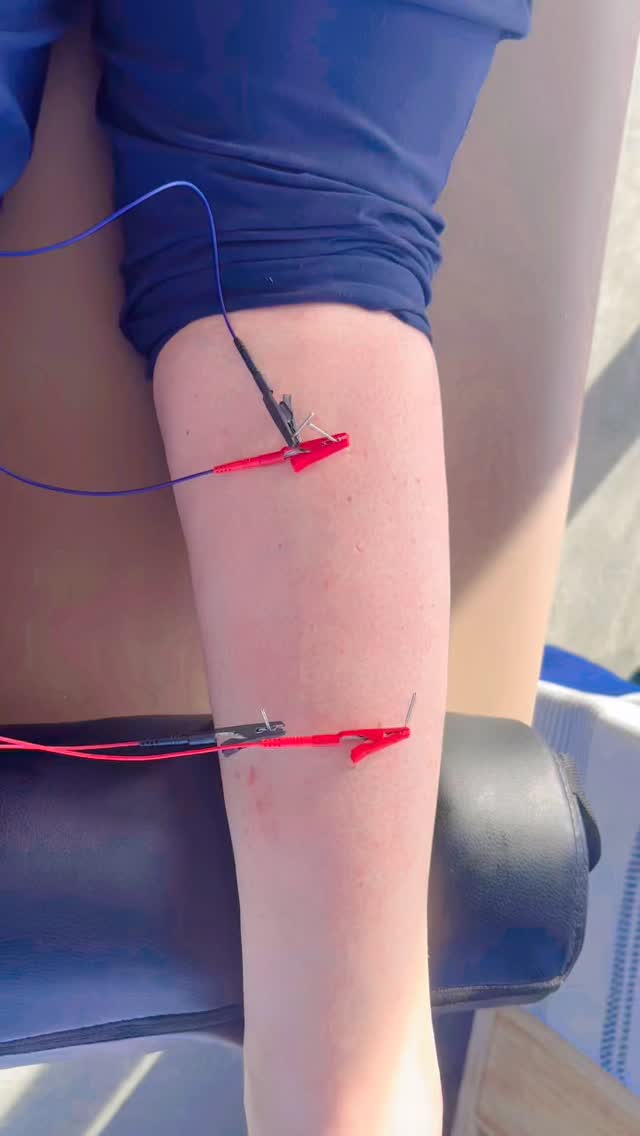 🦵⚡️Your Calves Aren’t Just for Looks⚡️🦵
Meet the gastrocs.
They’re in charge of push-off, power, jumping, sprinting,
